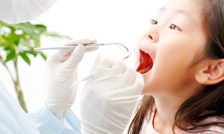 矯正治療中の虫歯や歯周病の予防を重視しています